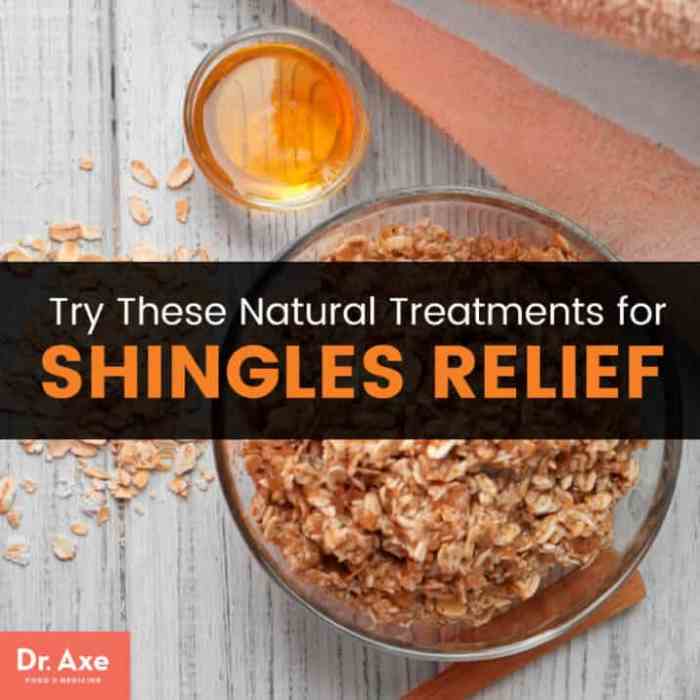 Shingles foods pain knock roof off